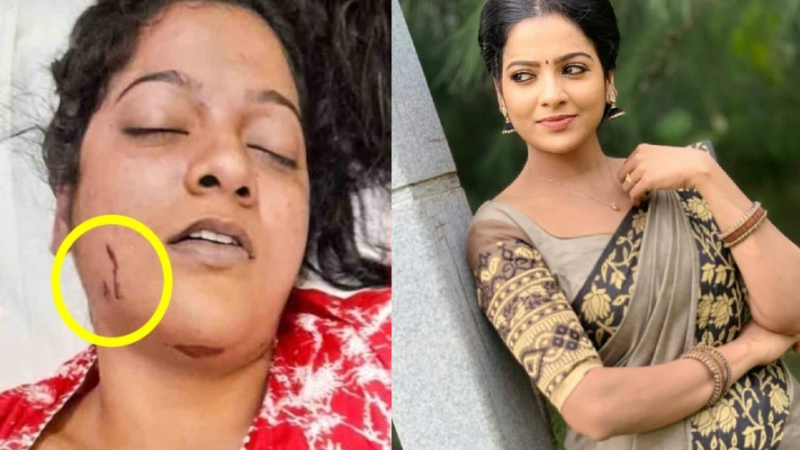 சின்னத்திரை நடிகை சித்ராவின் மரணம் தற்கொலை தான் என போலீசார் தகவல் தெரிவித்துள்ளனர்.